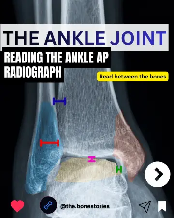 Reading the Ankle Xray preview