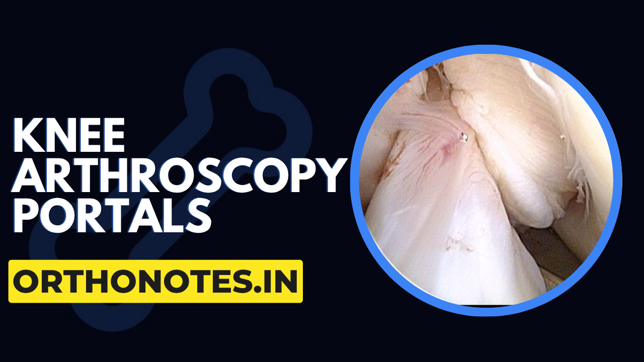 Knee Arthroscopy Basics & Portals Explained | Complete Beginner Guide