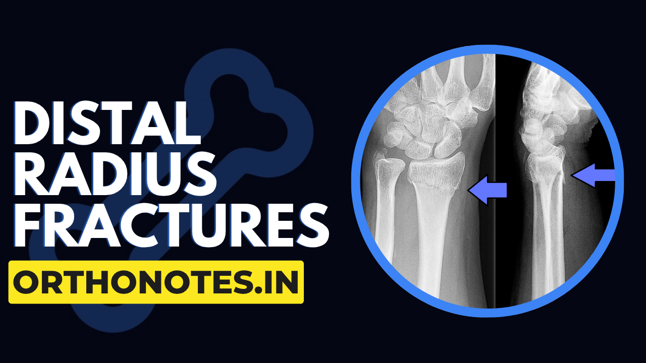 Distal Radius Fractures Explained | Classification, Principles & Management | The Bone Stories